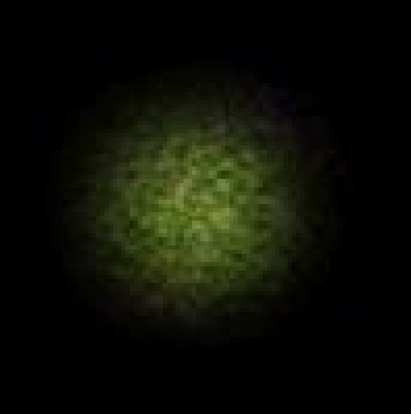 5396-Enlargementofgreenspot.JPG